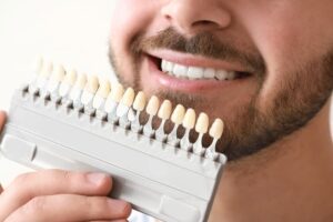 שיטות ציפוי שיניים
